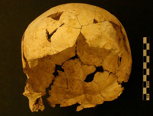 Crani d'humà modern (Homo sapiens) més antiga de Catalunya, trobat a Serinyà. Té una antiguitat d’uns 22.000 anys