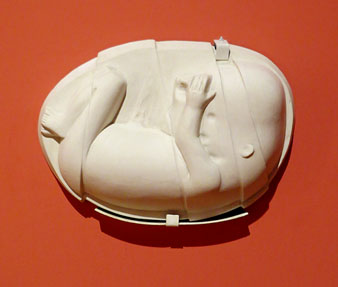 Fetus. 1971